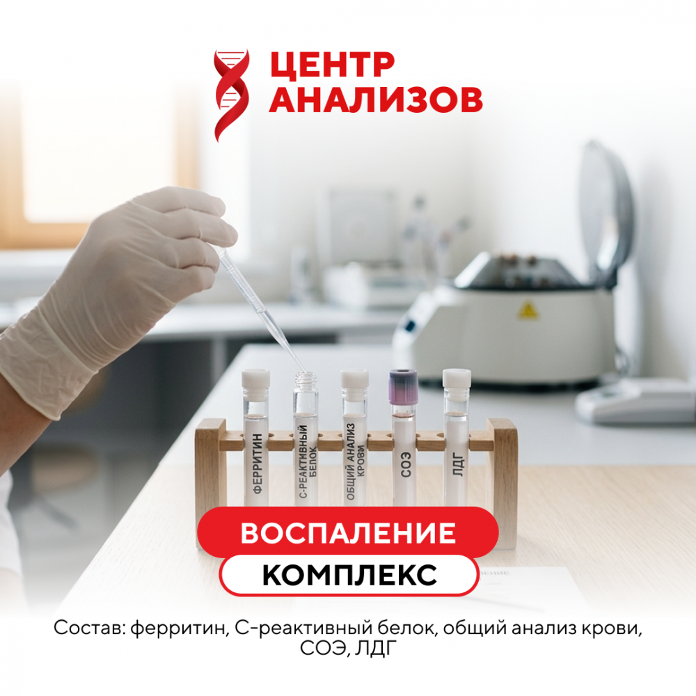 КОМПЛЕКС «ВОСПАЛЕНИЕ»