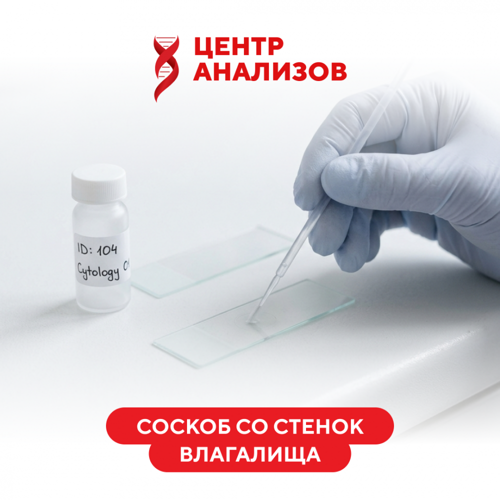 Соскоб со стенок влагалища (цитологическое исследование микропрепарата)
