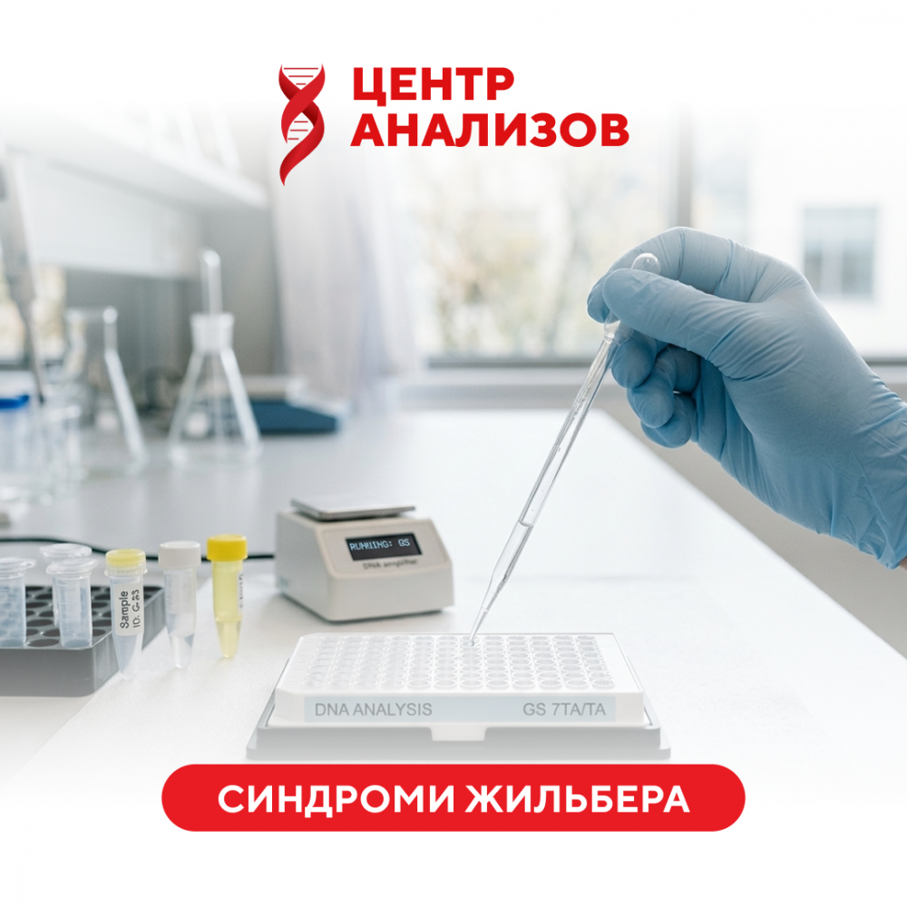 Синдром Жильбера