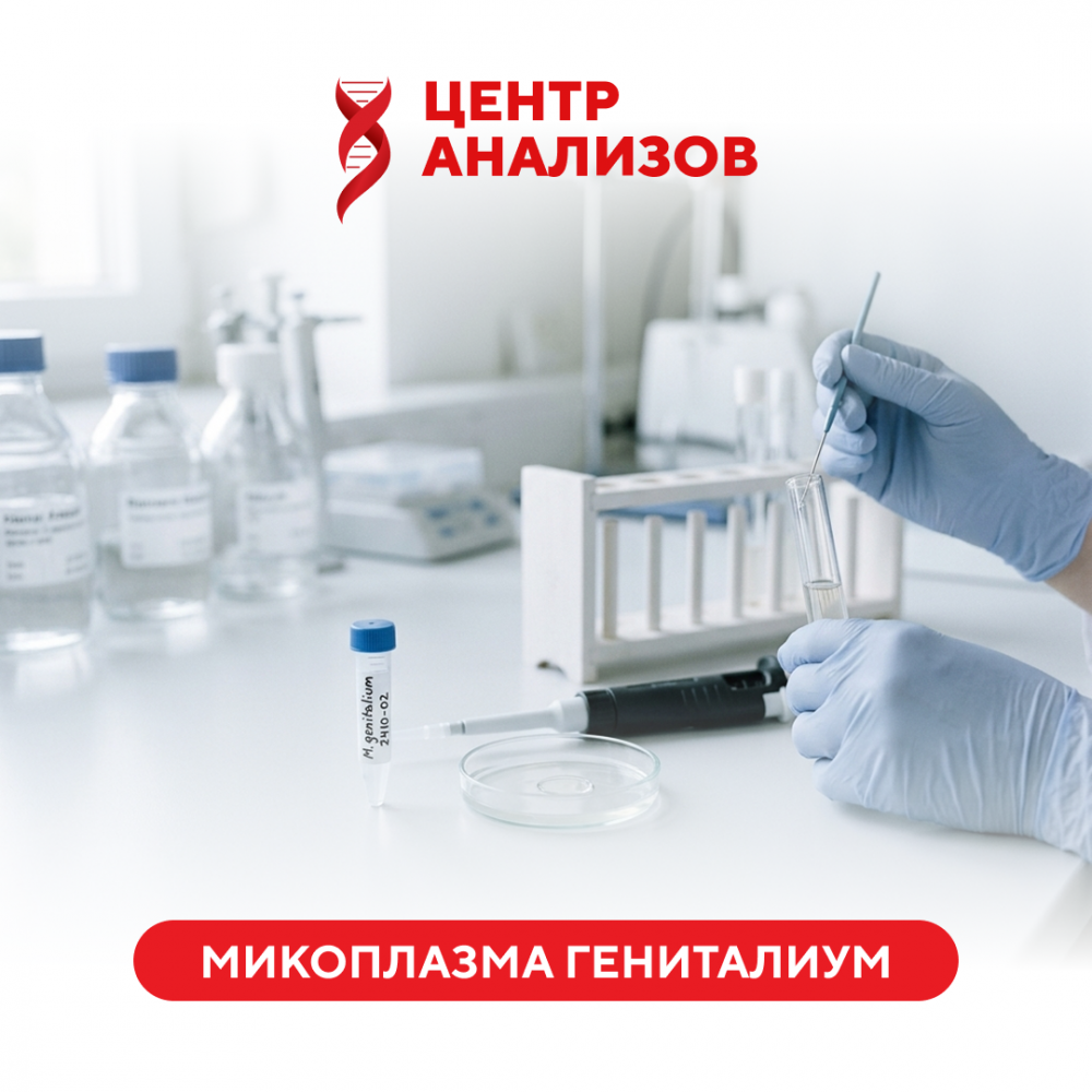 Микоплазма гениталиум (Mycoplasma genitalium) (ПЦР)