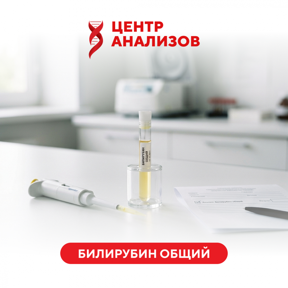 Билирубин общий