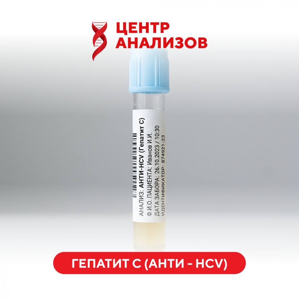 Гепатит С (АНТИ – HCV) (суммарные антитела) (ИФА)