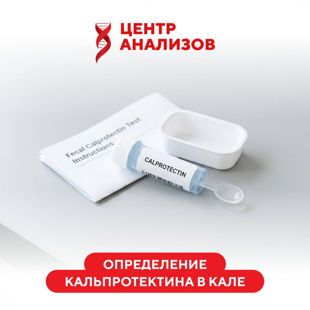 Определение кальпротектина в кале (полуколичественный метод)