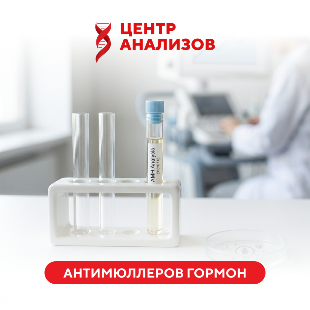 Антимюллеров гормон (AMH/MIS)