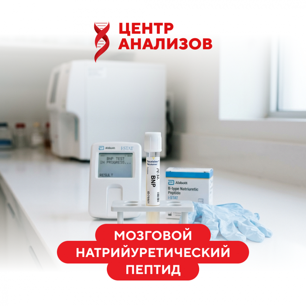 N-терминальный мозговой натрийуретический пропептид (NT-проBNP)