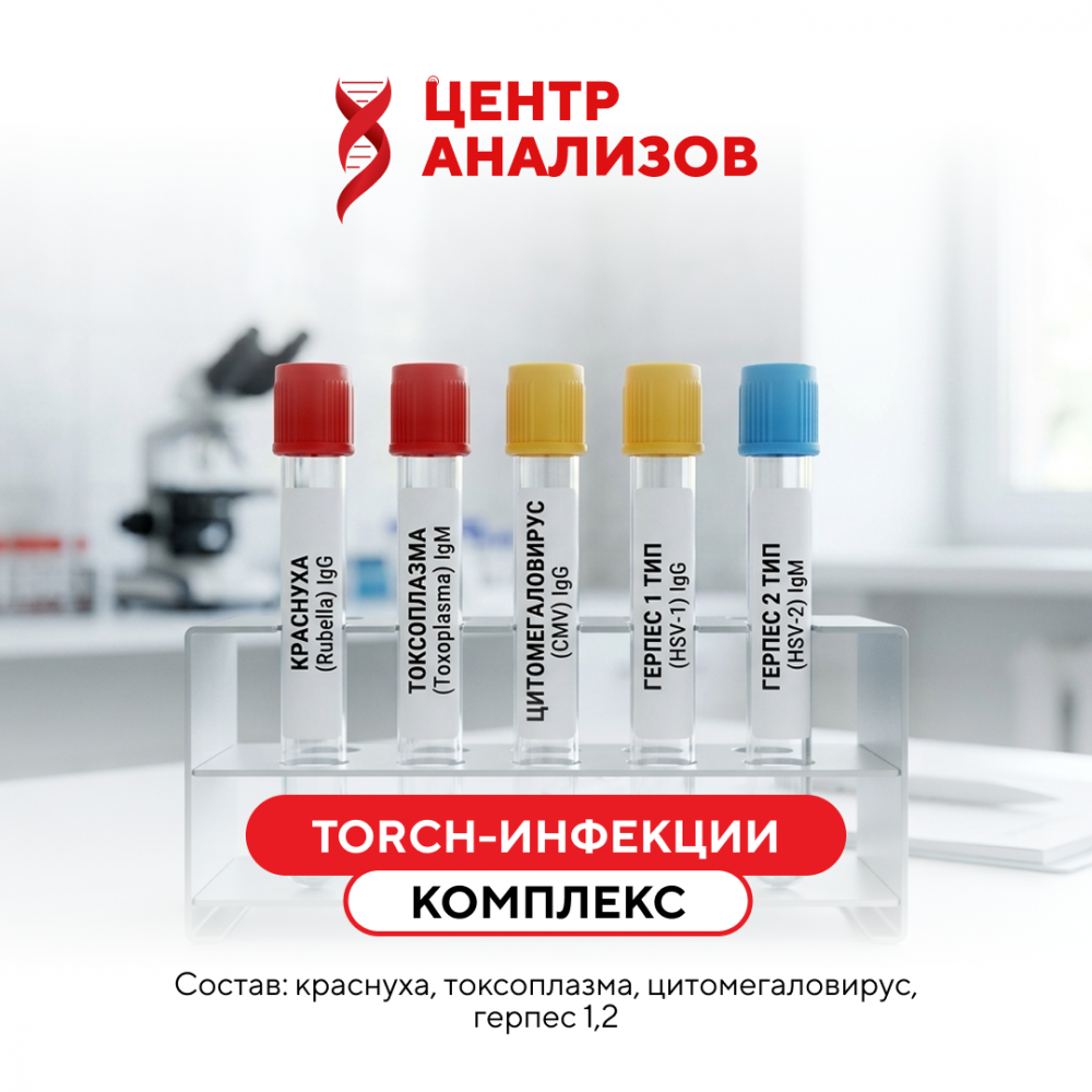 КОМПЛЕКС «TORCH - инфекции»