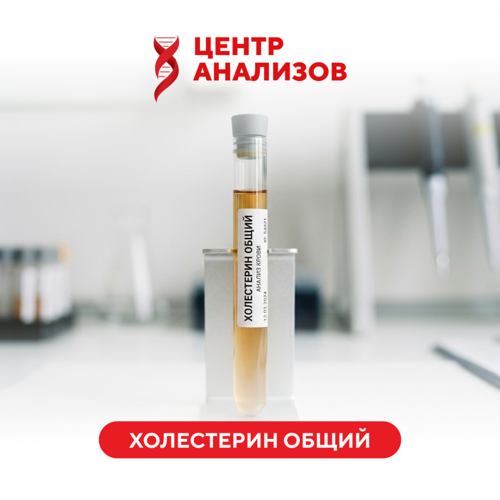 Холестерин общий