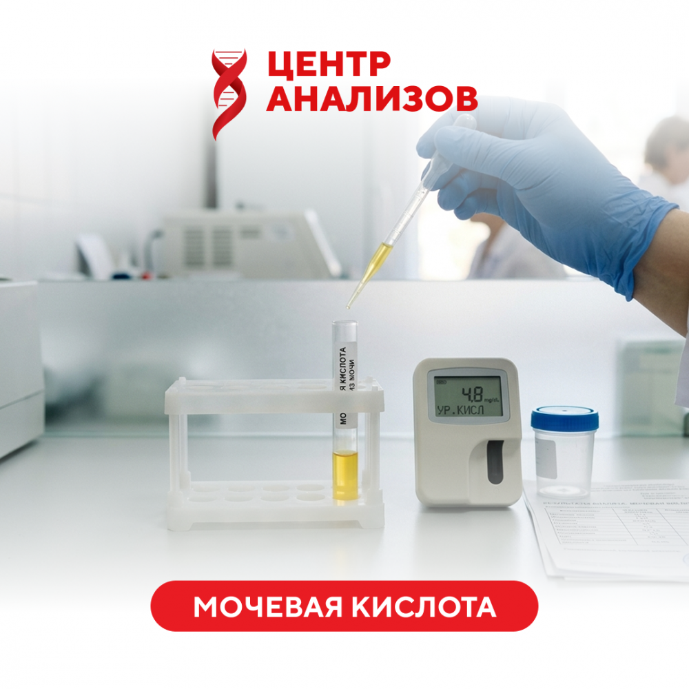 Мочевая кислота