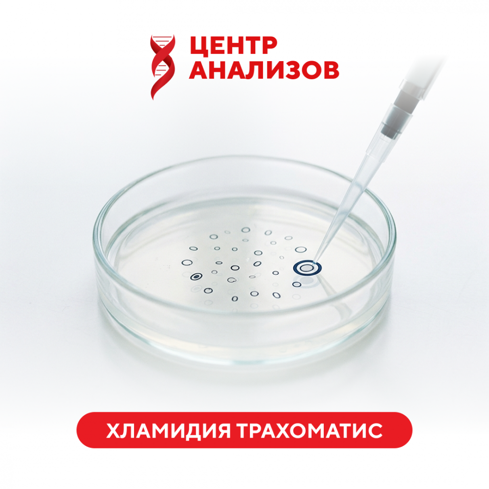 Хламидия трахоматис (Chlamydia trachomatis) (ПЦР)