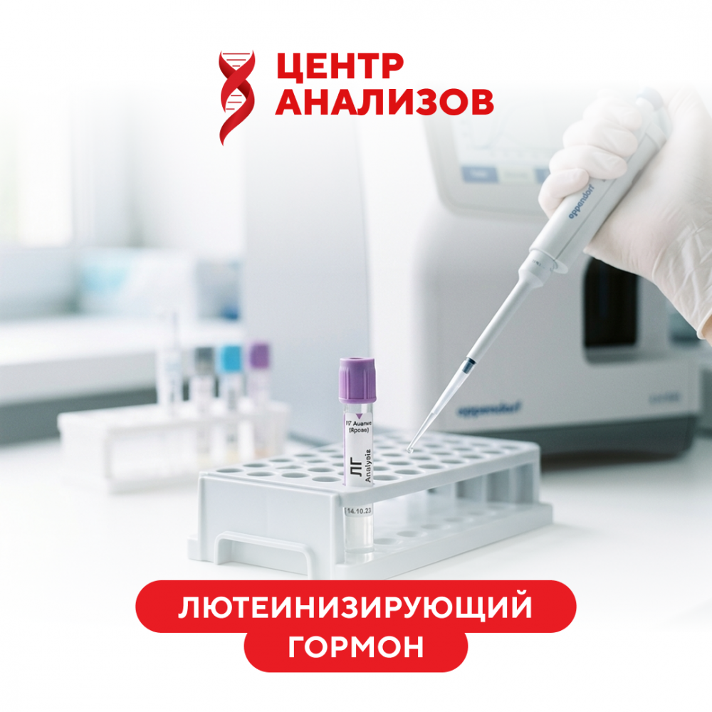 ЛГ (лютеинизирующий гормон)