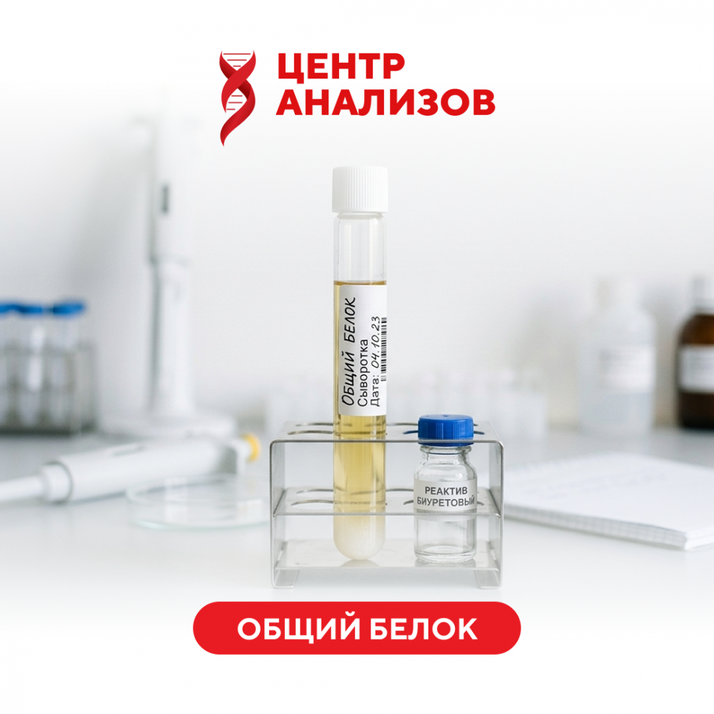 Общий белок