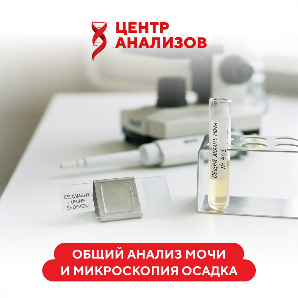 Анализ мочи на анализаторе 11 параметров + микроскопия осадка