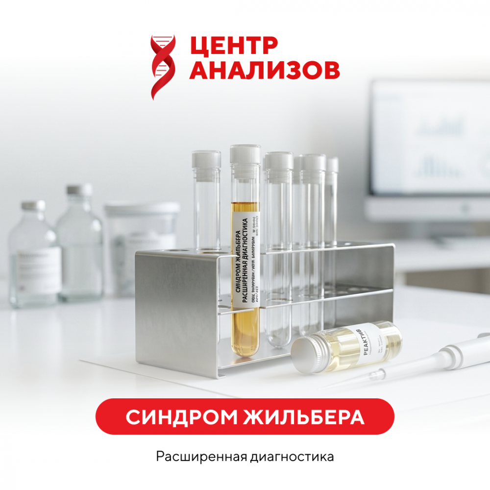 Синдром Жильбера (расширенная диагностика)