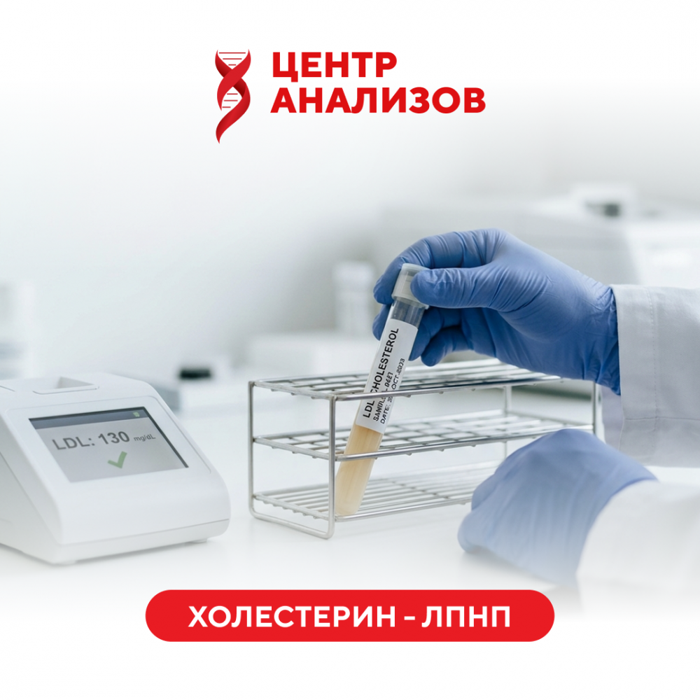 Холестерин - ЛПНП