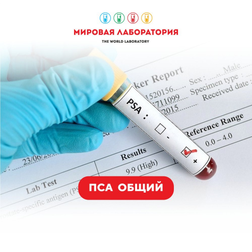 ПСА общий (простатспецифический антиген, общий)