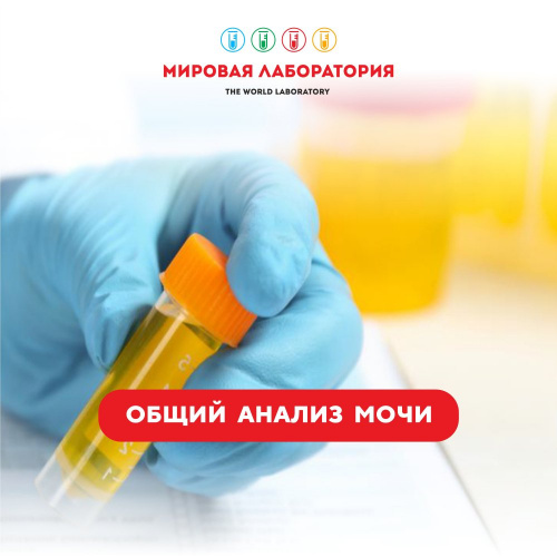 Общий анализ мочи на автоматическом анализаторе 11 параметров