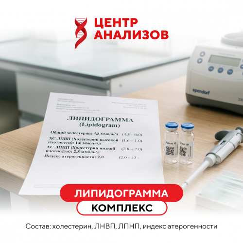 КОМПЛЕКС «ЛИПИДОГРАММА»
