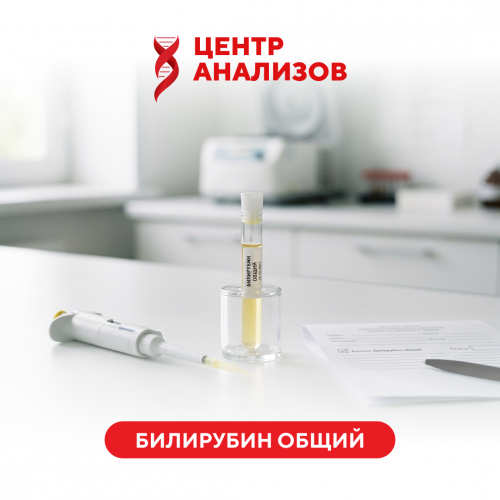 Билирубин общий