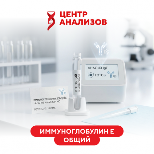 Иммуноглобулин Е общий