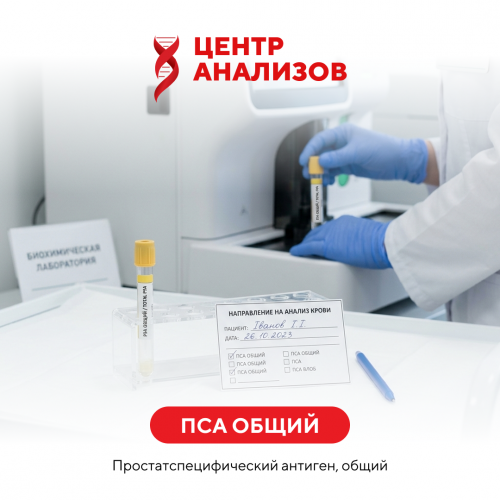 ПСА общий (простатспецифический антиген, общий)