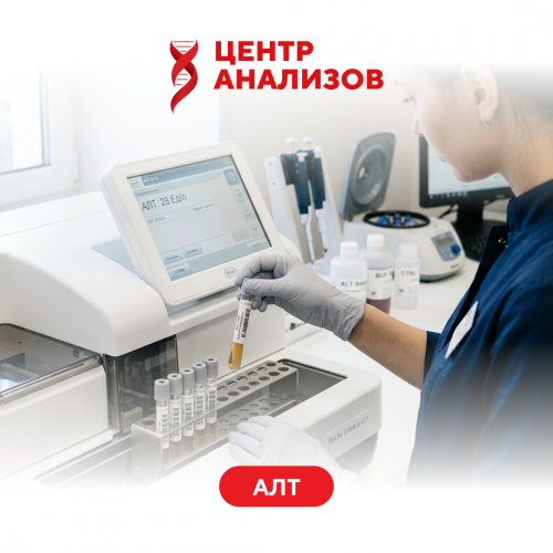 АЛТ  (аланинаминотрансфераза)